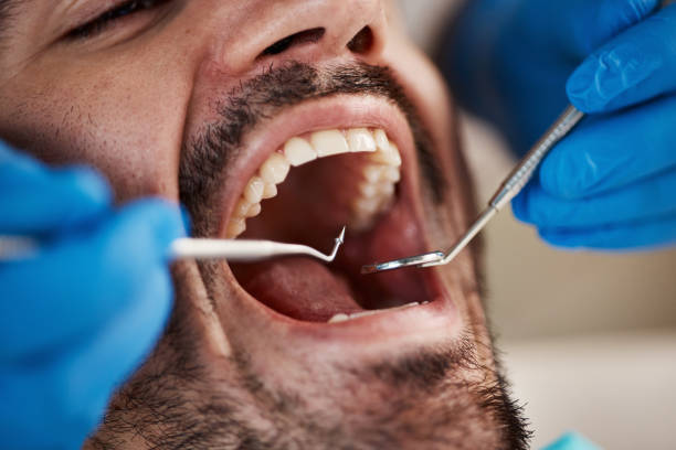 Best Tooth Extraction  in Camden, NJ
